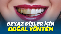 Doğal Diş Beyazlatma Yöntemleri, Doğal Diş Beyazlatma, Evde Diş Beyazlatma