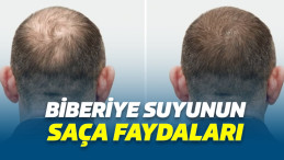 Biberiye Suyunun Saça Faydaları, Biberiye Suyu Nasıl Uygulanır?