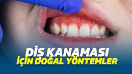 Diş Kanaması Neden Olur? Diş Kanaması Nedenleri, Diş Kanaması İçin Doğal Yöntemler