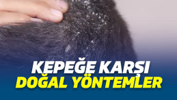 Kepek nasıl geçer? Kepeğe karşı doğal yöntemler