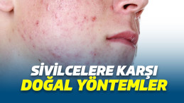 Sivilce neden oluşur? Sivilce nasıl kurutulur?Sivilcelere karşı doğal yöntemler