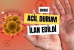 Maymun Çiçeği Virüsü Dünya Sağlık Örgütü’nden Acil Durum İlanı 