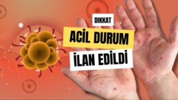 Maymun Çiçeği Virüsü Dünya Sağlık Örgütü’nden Acil Durum İlanı 